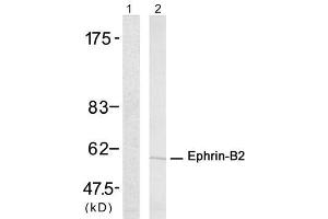 Western blot analysis of extract from A431 cells untreated or treated with Insulin, using Ephrin-B2 (Ab-330) antibody (E021196). (Ephrin B2 antibody)
