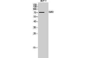 Western Blotting (WB) image for anti-Egf-Like Module Containing, Mucin-Like, Hormone Receptor-Like 2 (EMR2) (Internal Region) antibody (ABIN3188026)