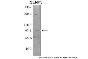 Sample Type: 1. (SENP3 antibody  (N-Term))
