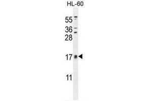 CNIH2 antibody  (N-Term)