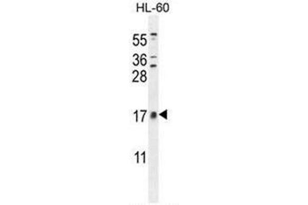 CNIH2 Antikörper  (N-Term)