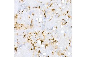 Immunohistochemistry of paraffin-embedded Rat brain using /IB antibody (ABIN7265554) at dilution of 1:100 (40x lens). (Iba1 antibody)