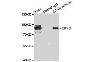Immunoprecipitation analysis of 200 μg extracts of 293T cells using 1 μg EIF4B antibody (ABIN5973134). (EIF4B antibody)