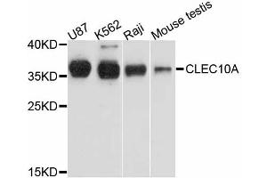 Western blot analysis of extracts of various cell lines, using CLEC10A antibody. (CLEC10A antibody)
