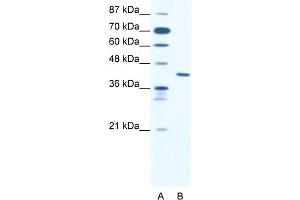 WB Suggested Anti-ZNF621 Antibody Titration:  2. (ZNF621 antibody  (Middle Region))