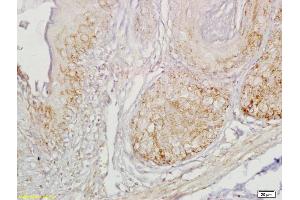 Immunohistochemistry (IHC) image for anti-Cholecystokinin B Receptor (CCKBR) (AA 301-400) antibody (ABIN734318)