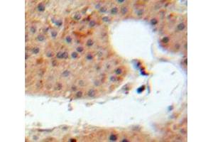 Used in DAB staining on fromalin fixed paraffin-embedded Liver tissue (IL-20 antibody  (AA 25-176))
