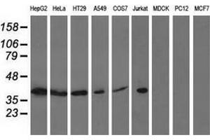 Western blot analysis of extracts (35 µg) from 9 different cell lines by using anti-ACAT2 monoclonal antibody. (ACAT2 antibody)