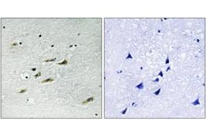 Immunohistochemistry analysis of paraffin-embedded human brain tissue, using JAK2 (Ab-931) Antibody. (JAK2 antibody  (AA 906-955))