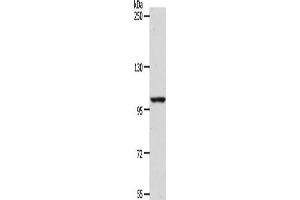 Gel: 8 % SDS-PAGE, Lysate: 40 μg, Lane: NIH/3T3 cells, Primary antibody: ABIN7189656(ADAMTS17 Antibody) at dilution 1/1200, Secondary antibody: Goat anti rabbit IgG at 1/8000 dilution, Exposure time: 1 hour (ADAMTS17 antibody)