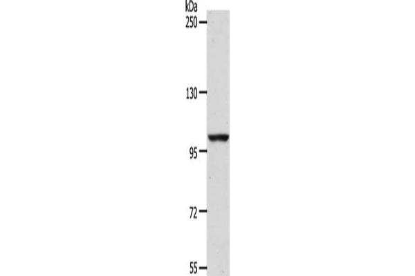 ADAMTS17 antibody