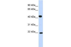 WB Suggested Anti-SSX4 Antibody Titration:  0. (SSX4 antibody  (N-Term))