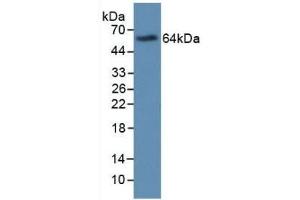 Detection of Recombinant MBP, Human using Monoclonal Antibody to Major Basic Protein (MBP)