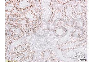 Formalin-fixed and paraffin embedded: rat kidney tissue labeled with Anti-CRF/CRH Polyclonal Antibody, Unconjugated (ABIN739430) at 1:200, followed by conjugation to the secondary antibody and DAB staining (CRH antibody  (AA 145-185))