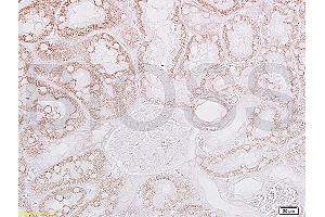 Formalin-fixed and paraffin embedded: rat kidney tissue labeled with Anti-CRF/CRH Polyclonal Antibody, Unconjugated (ABIN739430) at 1:200, followed by conjugation to the secondary antibody and DAB staining