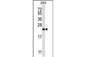 Western blot analysis in 293 cell line lysates (35ug/lane). (RAB1B antibody  (C-Term))