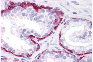 Human Prostate: Formalin-Fixed, Paraffin-Embedded (FFPE) (KRT20 antibody  (AA 1-425))