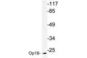 Western blot analyzes of Op18 antibody in extracts from HepG2 cells. (Stathmin 1 antibody)