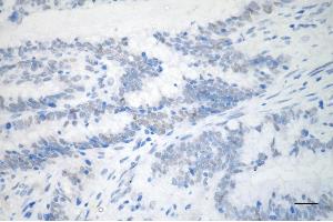 anti-Tripartite Motif Containing 24 (TRIM24) antibody