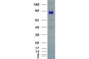 Western Blotting (WB) image for Discoidin Domain Receptor tyrosine Kinase 2 (DDR2) (Transcript Variant 2) protein (Myc-DYKDDDDK Tag) (ABIN2713457)