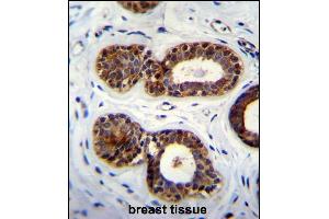 Immunohistochemistry (Paraffin-embedded Sections) (IHC (p)) image for anti-Queuine tRNA-Ribosyltransferase Domain Containing 1 (QTRTD1) (AA 321-350), (C-Term) antibody (ABIN655642)