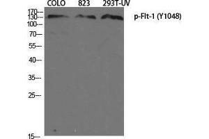 Western Blotting (WB) image for anti-Fms-Related tyrosine Kinase 1 (VEGFR1) (FLT1) (pTyr1048) antibody (ABIN3182936) (FLT1 antibody  (pTyr1048))