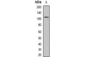 Western blot analysis of GLUR1 expression in rat kidney (A) whole cell lysates.
