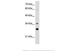 Image no. 1 for anti-Ribosomal Protein, Large, P0 (RPLP0) (AA 182-231) antibody (ABIN203302)
