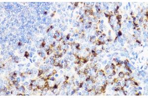 Immunohistochemistry of paraffin-embedded Mouse spleen using YKL-40 / CHI3L1 Polyclonal Antibody at dilution of 1:100 (40x lens).