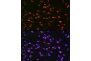 Immunofluorescence analysis of C6 cells using Phospho-Histone H3-S10 Rabbit pAb (ABIN7267687) at dilution of 1:100 (40x lens).