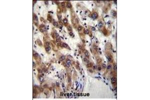 PHF20 Antibody (N-term) (ABIN656095 and ABIN2845438) immunohistochemistry analysis in formalin fixed and paraffin embedded human liver tissue followed by peroxidase conjugation of the secondary antibody and DAB staining. (PHF20 antibody  (N-Term))