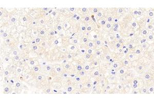 Detection of Hepc in Human Liver Tissue using Polyclonal Antibody to Hepcidin (Hepc) (Hepcidin antibody  (AA 25-84))