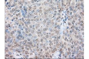 Immunohistochemical staining of paraffin-embedded Human colon tissue using anti-SNX9 mouse monoclonal antibody. (SNX9 antibody)