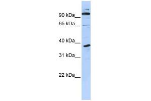 WB Suggested Anti-PHF11 Antibody Titration:  0. (PHF11 antibody  (N-Term))