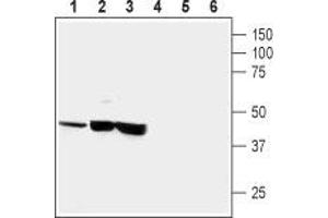 Western blot analysis of human neuroblastoma (SH-SY5Y) (lanes 1 and 4), human brain astrocytoma (CCF-STTGI) (lanes 2 and 5) and rat pheochromocytoma (PC12) (lanes 3 and 6): - 1-3. (CRHR1 antibody  (Extracellular, N-Term))