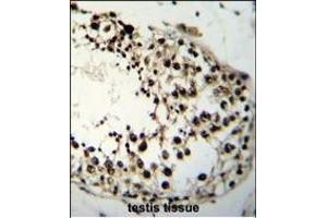 Immunohistochemistry (Paraffin-embedded Sections) (IHC (p)) image for anti-Lin-28 Homolog A (C. Elegans) (LIN28A) (AA 108-138) antibody (ABIN655156)