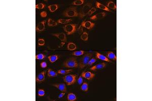 Immunofluorescence analysis of NIH-3T3 cells using F Rabbit mAb (ABIN1682600, ABIN3018533, ABIN3018534 and ABIN7101623) at dilution of 1:100 (40x lens). (FAAH antibody)