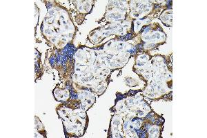 Immunohistochemistry of paraffin-embedded human placenta using FA Rabbit pAb (ABIN7267102) at dilution of 1:100 (40x lens). (FAM117A antibody)