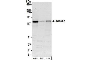 anti-Cell Division Cycle Associated 2 (CDCA2) (AA 200-250) antibody