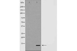 Western blot analysis of Hela whole cell lysates, using GLRX Antibody. (Glutaredoxin 1 antibody  (N-Term))