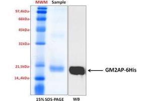 Western Blotting (WB) image for GM2 Ganglioside Activator (GM2A) (Isoform 1) protein (His tag) (ABIN5675809)