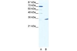 Western Blot showing MAGEA9 antibody used at a concentration of 1-2 ug/ml to detect its target protein. (MAGEA9 antibody  (N-Term))