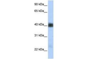 Image no. 1 for anti-Sarcoglycan, beta (43kDa Dystrophin-Associated Glycoprotein) (SGCB) (AA 180-229) antibody (ABIN6740863) (SGCB antibody  (AA 180-229))