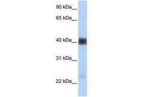 Image no. 1 for anti-Sarcoglycan, beta (43kDa Dystrophin-Associated Glycoprotein) (SGCB) (AA 180-229) antibody (ABIN6740863)