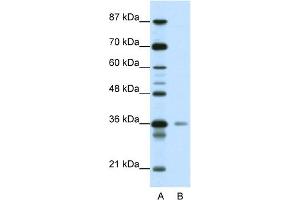 WB Suggested Anti-HMG20A Antibody Titration:  0. (HMG20A antibody  (C-Term))