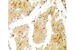 Immunohistochemistry of paraffin-embedded Human esophagus using MVP Polyclonal Antibody at dilution of 1:100 (40x lens). (MVP antibody)