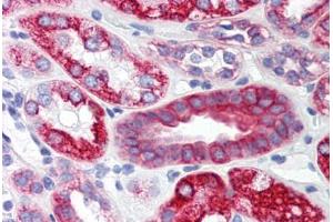 Human Kidney (formalin-fixed, paraffin-embedded) stained with SCO2 antibody ABIN214472 at 2. (SCO2 antibody  (C-Term))