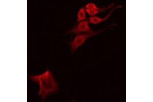 ABIN6274812 staining 293 by IF/ICC.