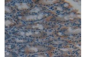 Detection of GSTk1 in Mouse Intestine Tissue using Polyclonal Antibody to Glutathione S Transferase Kappa 1 (GSTk1) (GSTK1 antibody  (AA 19-222))