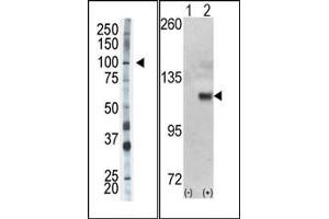 Image no. 1 for anti-Hexokinase 1 (HK1) (N-Term) antibody (ABIN360644) (Hexokinase 1 antibody  (N-Term))